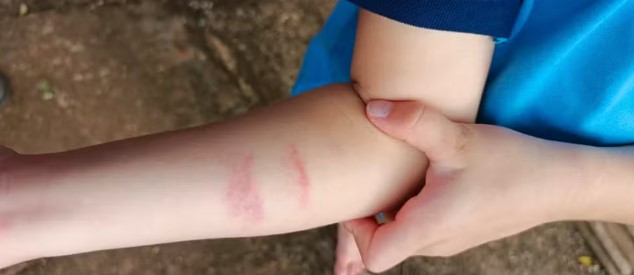 Mãe denuncia agressão contra filho autista em escola de RO | Foto: Redes sociais