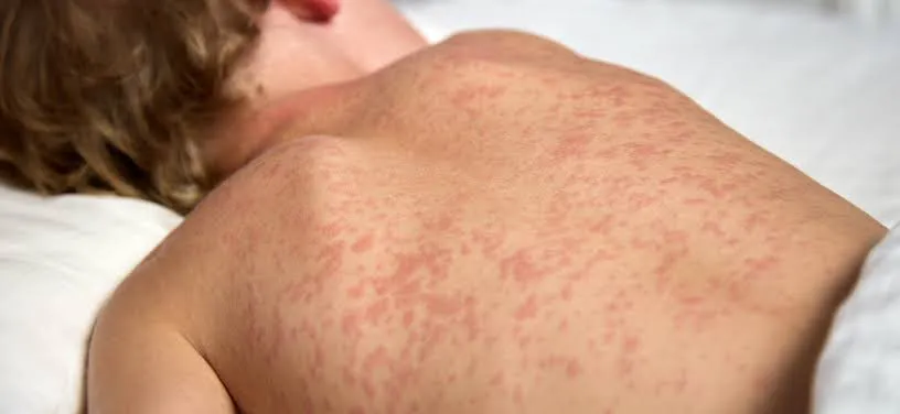 (Imagem ilustrativa)