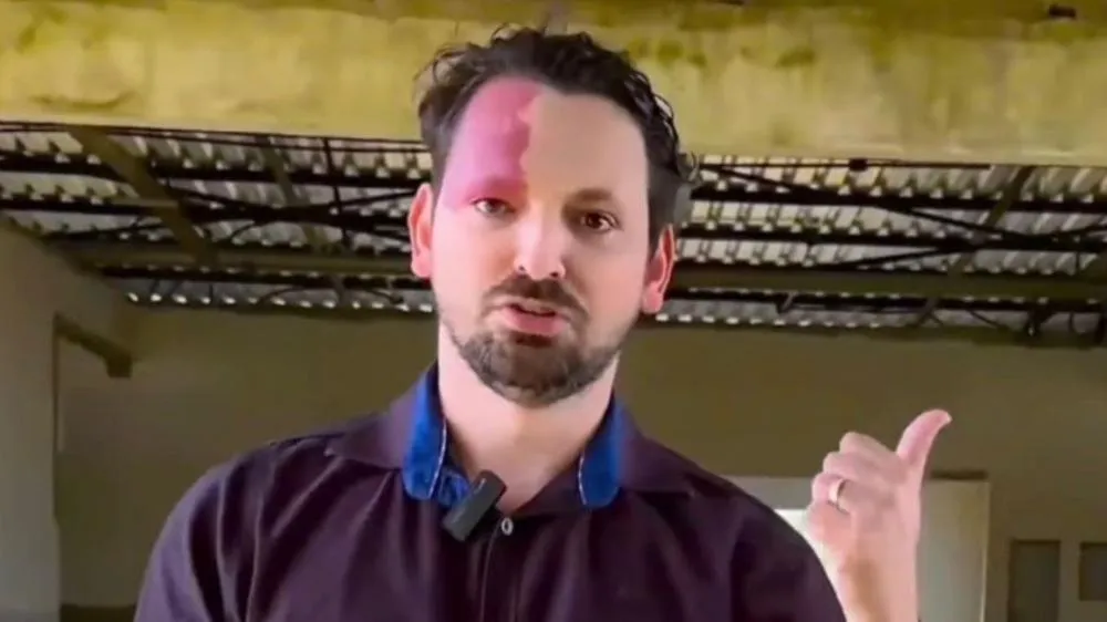 A farsa da “censura”: Vereador Ivan da Farmácia tenta descredibilizar imprensa após cobrança sobre o Canal