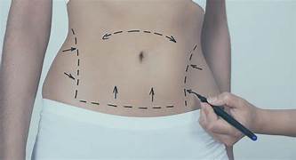 Reprodução - Imagem Ilustrativa