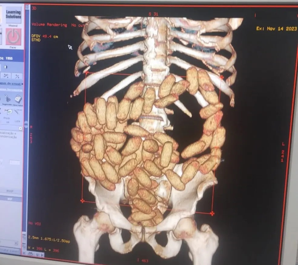 Reprodução - Divulgação